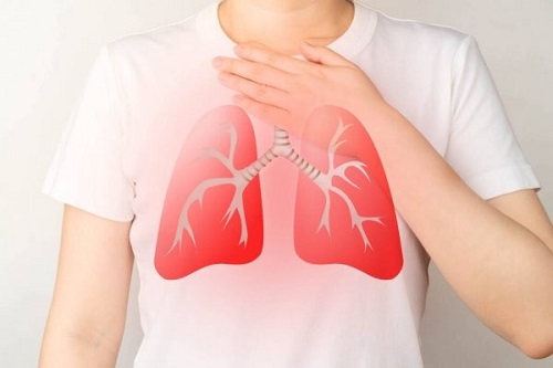 fibrosis pulmonar